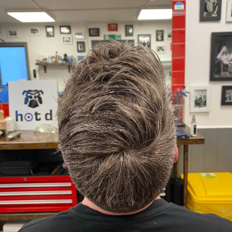 Hair Replacement System