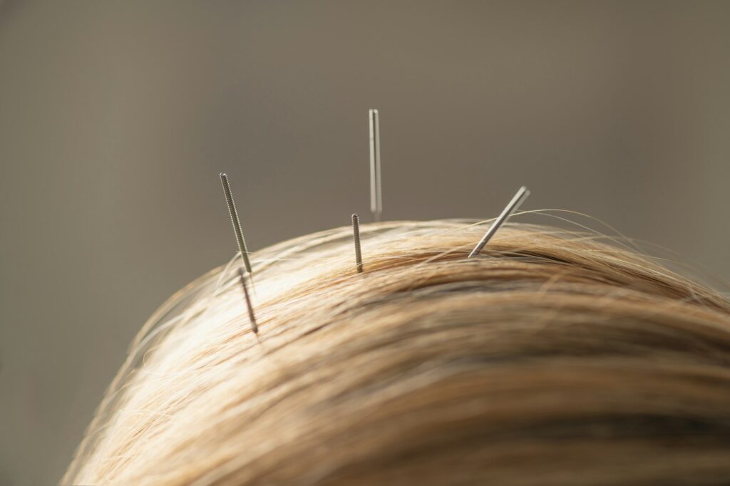 Hair Loss Treatment
