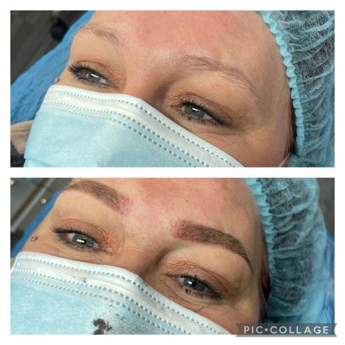 Microblading