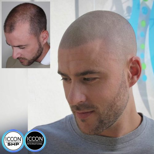 SMP before and after at hot-d salon exmouth